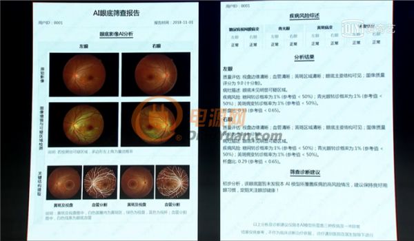 前沿|李彦宏说百度吹的牛都实现了，还扔出来ACE计划